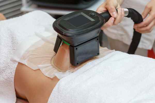 Areas of the Body we treat Cryolipolysis Kingswinford