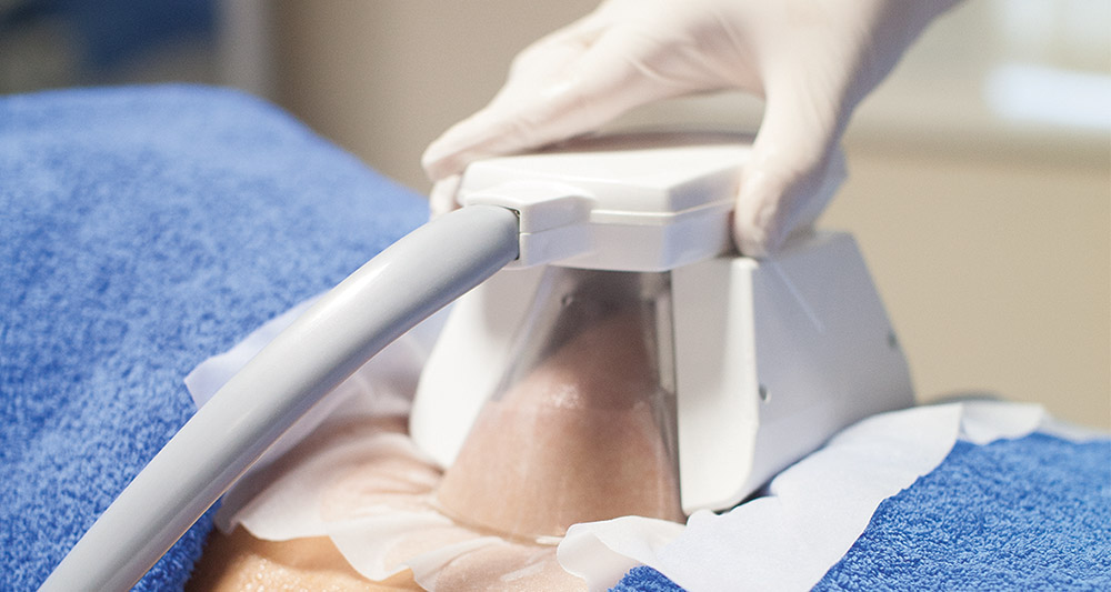 How Fat Freezing and HIFU Work Together? 2 Multiple Areas in One Session HIFU and Fat Freezing Kingswinford