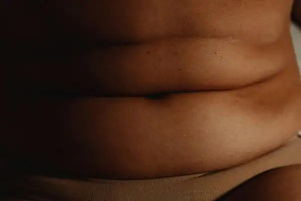 The Hidden Connection: How Stress Shapes Your Fitness and Body Composition 3 image of what stress can do on the stomach area and how Lipo 360 Kingswinford can help to change your body shape.
